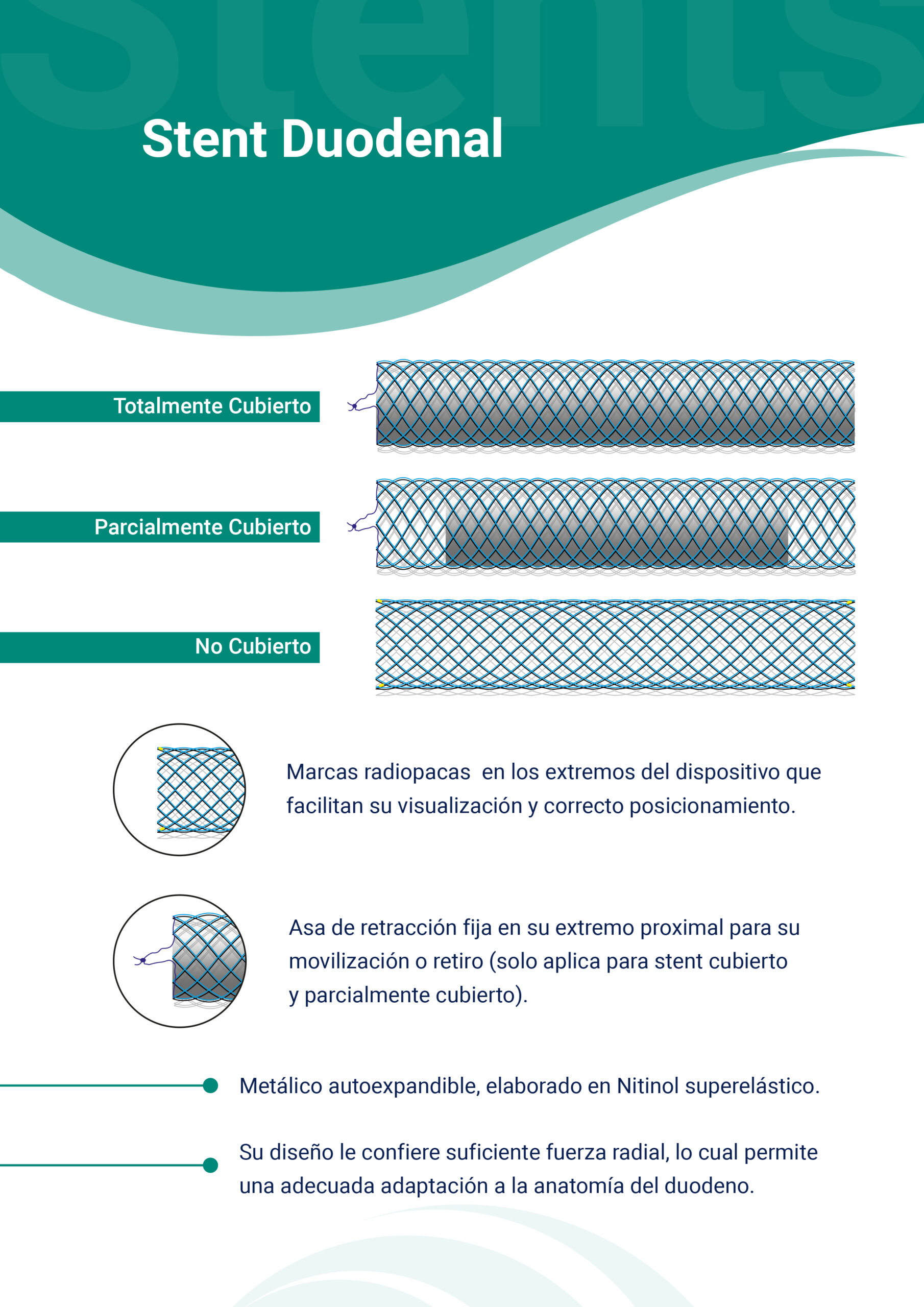 Stent Duodenal Stent Duodenal