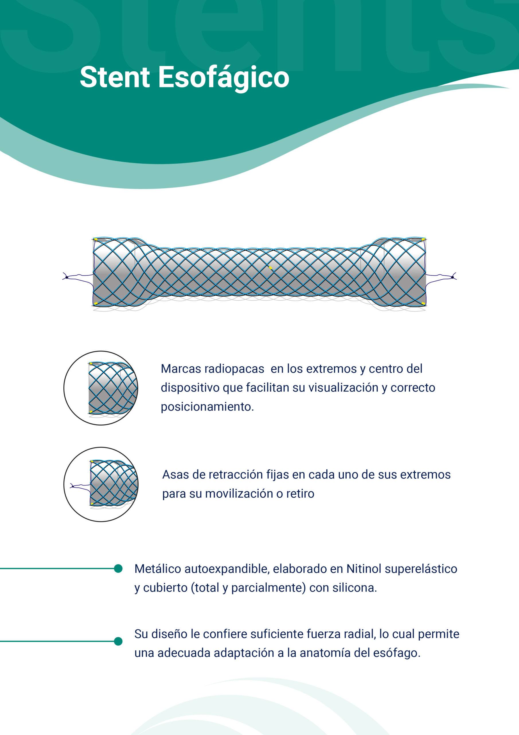 Stents Esofágicos Metálicos autoexpandibles Stents Esofágicos Metálicos autoexpandibles