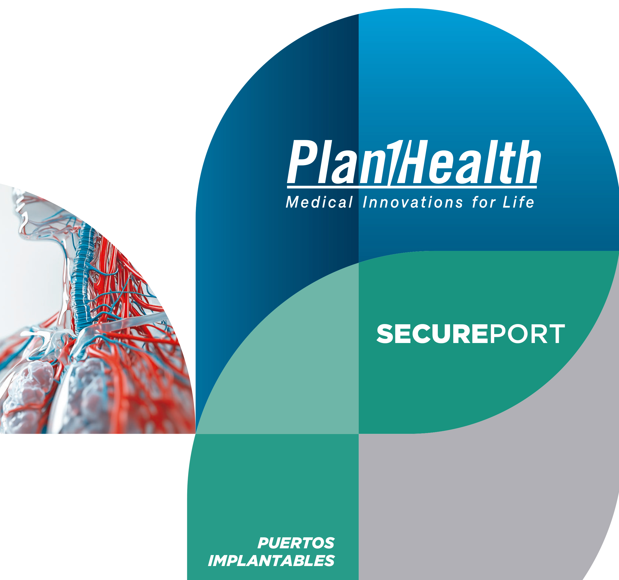 Secure Port Puertos Implantables