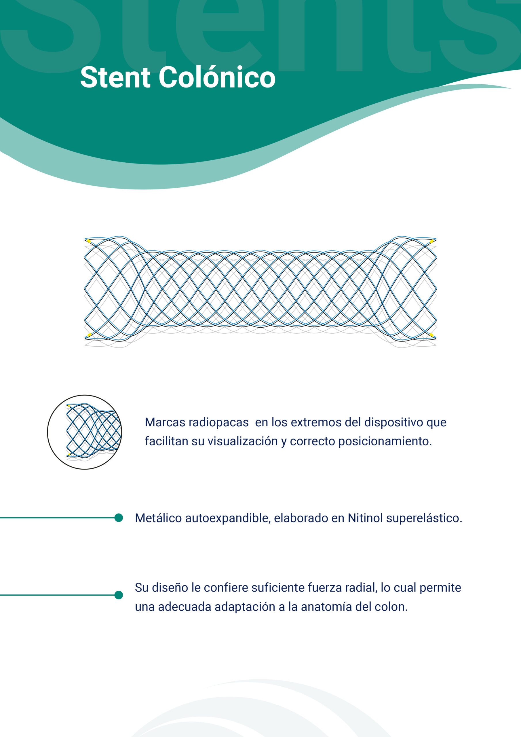 Stent Colónico Stent Colónico