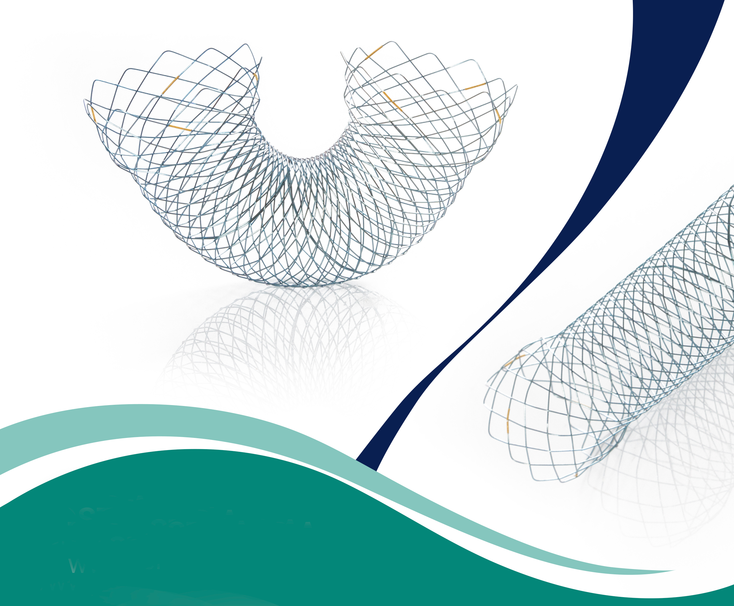 Stent Colónico